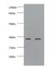 Growth Differentiation Factor 15 antibody, LS-C211444, Lifespan Biosciences, Western Blot image 