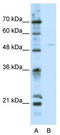 Transcription Factor EB antibody, TA343618, Origene, Western Blot image 