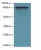 Internalin-A antibody, A65630-100, Epigentek, Western Blot image 