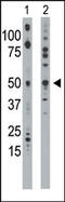 Ethanolamine kinase 1 antibody, AP13631PU-N, Origene, Western Blot image 