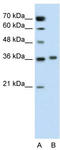 Peroxisomal sarcosine oxidase antibody, TA344132, Origene, Western Blot image 