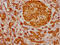 Tumor Protein P63 antibody, CSB-RA887971A0HU, Cusabio, Immunohistochemistry frozen image 