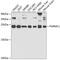 Progesterone Receptor Membrane Component 1 antibody, 19-760, ProSci, Western Blot image 