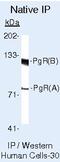 Progesterone Receptor antibody, MA5-12653, Invitrogen Antibodies, Immunoprecipitation image 