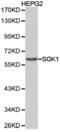 Serum/Glucocorticoid Regulated Kinase 1 antibody, LS-C192515, Lifespan Biosciences, Western Blot image 