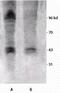 Phosphothreonine antibody, NB110-96896, Novus Biologicals, Western Blot image 