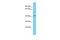 NADH:Ubiquinone Oxidoreductase Complex Assembly Factor 7 antibody, A12013, Boster Biological Technology, Western Blot image 