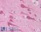 TGF-Beta Activated Kinase 1 (MAP3K7) Binding Protein 2 antibody, LS-B4704, Lifespan Biosciences, Immunohistochemistry frozen image 