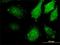 Mitogen-Activated Protein Kinase Kinase Kinase 20 antibody, H00051776-M02, Novus Biologicals, Immunofluorescence image 