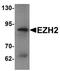Enhancer Of Zeste 2 Polycomb Repressive Complex 2 Subunit antibody, TA319648, Origene, Western Blot image 