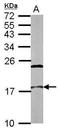 Nuclear Cap Binding Protein Subunit 2 antibody, GTX115648, GeneTex, Western Blot image 