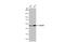 Hydroxyacyl-CoA Dehydrogenase Trifunctional Multienzyme Complex Subunit Beta antibody, GTX100302, GeneTex, Western Blot image 