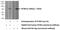 Proprotein Convertase Subtilisin/Kexin Type 2 antibody, 10553-1-AP, Proteintech Group, Western Blot image 