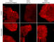 3-Phosphoinositide Dependent Protein Kinase 1 antibody, PM1461, ECM Biosciences, Immunocytochemistry image 