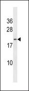 Heart And Neural Crest Derivatives Expressed 2 antibody, PA5-13111, Invitrogen Antibodies, Western Blot image 