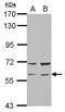 Rap1 GTPase-GDP Dissociation Stimulator 1 antibody, LS-C155249, Lifespan Biosciences, Western Blot image 