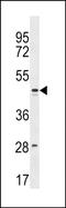 Family With Sequence Similarity 155 Member B antibody, PA5-49013, Invitrogen Antibodies, Western Blot image 