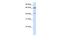 Cilia And Flagella Associated Protein 45 antibody, PA5-43685, Invitrogen Antibodies, Western Blot image 