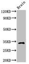 Caspase 6 antibody, CSB-PA004551EA01HU, Cusabio, Western Blot image 