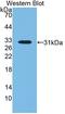 Lipopolysaccharide Binding Protein antibody, LS-C295181, Lifespan Biosciences, Western Blot image 