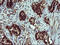 Forkhead Box P1 antibody, M00723-2, Boster Biological Technology, Immunohistochemistry paraffin image 