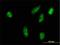 Ribosomal Protein S6 Kinase A2 antibody, H00006196-M01, Novus Biologicals, Immunocytochemistry image 
