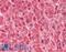 Lipoprotein Lipase antibody, LS-B11634, Lifespan Biosciences, Immunohistochemistry frozen image 