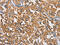 Clathrin Heavy Chain antibody, CSB-PA777315, Cusabio, Immunohistochemistry paraffin image 