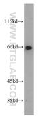 Transcription Factor EB antibody, 13372-1-AP, Proteintech Group, Western Blot image 