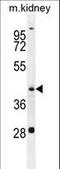 Glutamic-Oxaloacetic Transaminase 1 Like 1 antibody, LS-C166586, Lifespan Biosciences, Western Blot image 