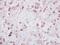 IKAROS Family Zinc Finger 2 antibody, NBP2-16802, Novus Biologicals, Immunohistochemistry paraffin image 