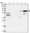 CAP-Gly Domain Containing Linker Protein Family Member 4 antibody, NBP1-91793, Novus Biologicals, Western Blot image 