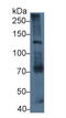 Laminin Subunit Beta 3 antibody, LS-C717565, Lifespan Biosciences, Western Blot image 