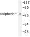 Peripherin antibody, LS-C176179, Lifespan Biosciences, Western Blot image 