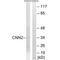 Calponin 2 antibody, A08680, Boster Biological Technology, Western Blot image 