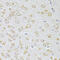 NTS1 antibody, 14-365, ProSci, Immunohistochemistry paraffin image 