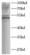Chitinase Acidic antibody, FNab10104, FineTest, Western Blot image 