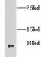 C-X-C Motif Chemokine Ligand 1 antibody, FNab03658, FineTest, Western Blot image 