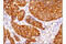 Progesterone Receptor Membrane Component 1 antibody, 13856S, Cell Signaling Technology, Immunohistochemistry paraffin image 