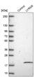 Electron Transfer Flavoprotein Regulatory Factor 1 antibody, PA5-60660, Invitrogen Antibodies, Western Blot image 