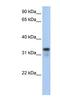 Glycine-N-Acyltransferase Like 2 antibody, NBP1-54782, Novus Biologicals, Western Blot image 