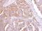Pleckstrin Homology Domain Containing A5 antibody, PA5-32032, Invitrogen Antibodies, Immunohistochemistry paraffin image 