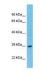 T Cell-Interacting, Activating Receptor On Myeloid Cells 1 antibody, orb327113, Biorbyt, Western Blot image 