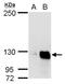 Glycine Decarboxylase antibody, TA308885, Origene, Western Blot image 