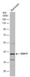 G Protein Subunit Alpha 11 antibody, GTX118876, GeneTex, Western Blot image 