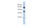 Phospholipase A2 Group IVB antibody, A30134, Boster Biological Technology, Western Blot image 