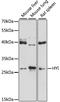 Hydroxypyruvate Isomerase (Putative) antibody, LS-C747878, Lifespan Biosciences, Western Blot image 