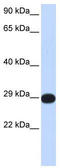 Protein Phosphatase 4 Catalytic Subunit antibody, TA344304, Origene, Western Blot image 