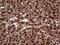 Transaldolase 1 antibody, M06530, Boster Biological Technology, Immunohistochemistry paraffin image 