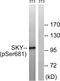 MER Proto-Oncogene, Tyrosine Kinase antibody, A00489Y749, Boster Biological Technology, Western Blot image 